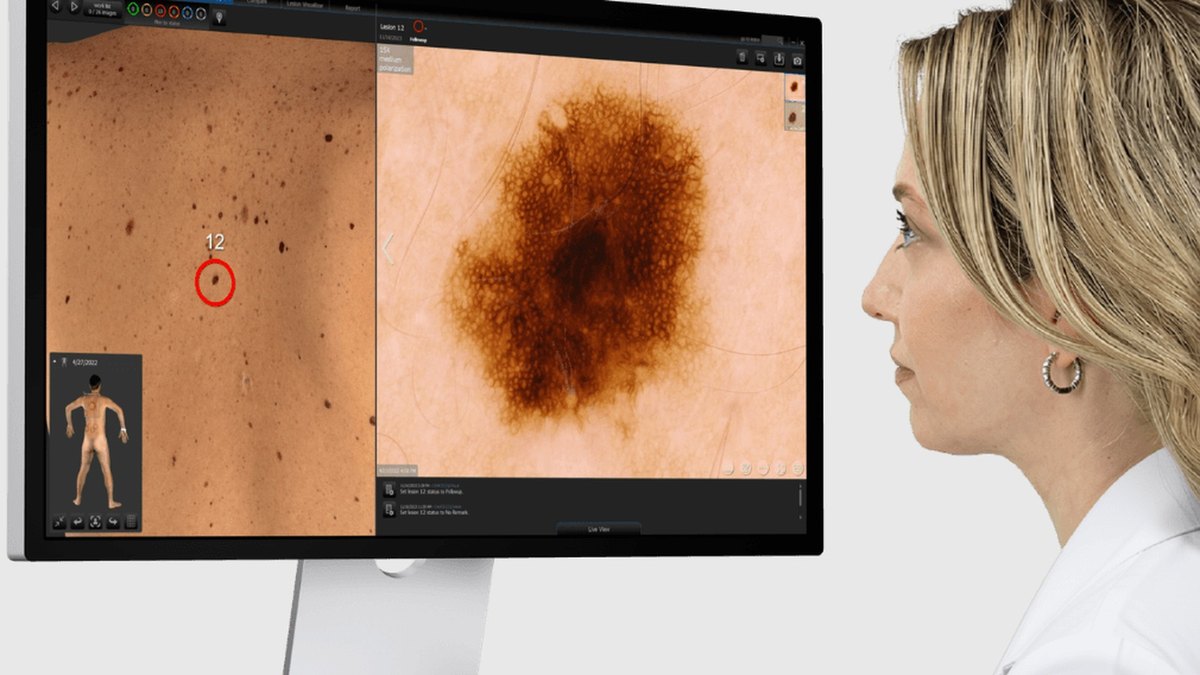 Canfield DermaGraphix