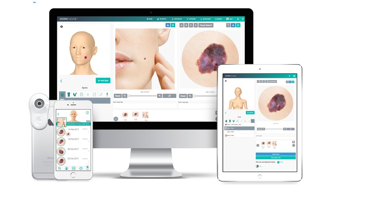 DermEngine